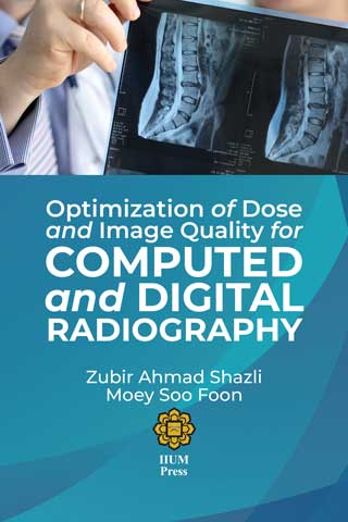 Optimizing of Dose and Image Quality for Computed and Digital Radiography